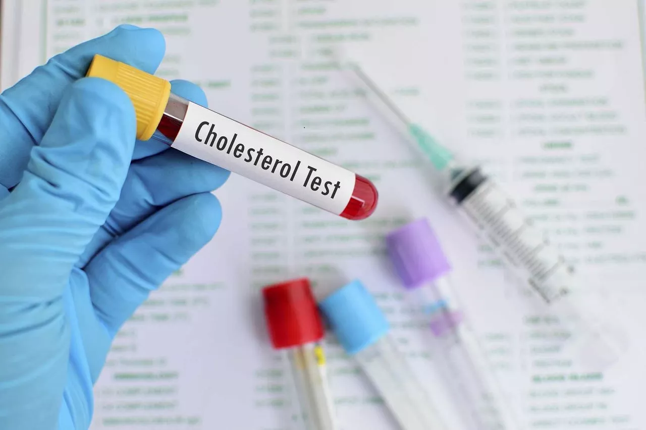 cholesterol trong máu cao nên ăn gì