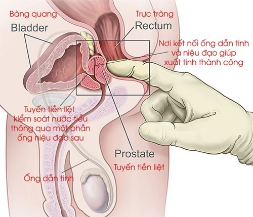 vị trí tuyền tiền liệt